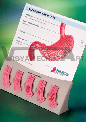 Esophagitis Model